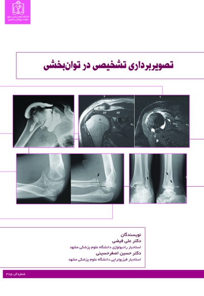 تصویربرداری تشخیصی در توان بخشی